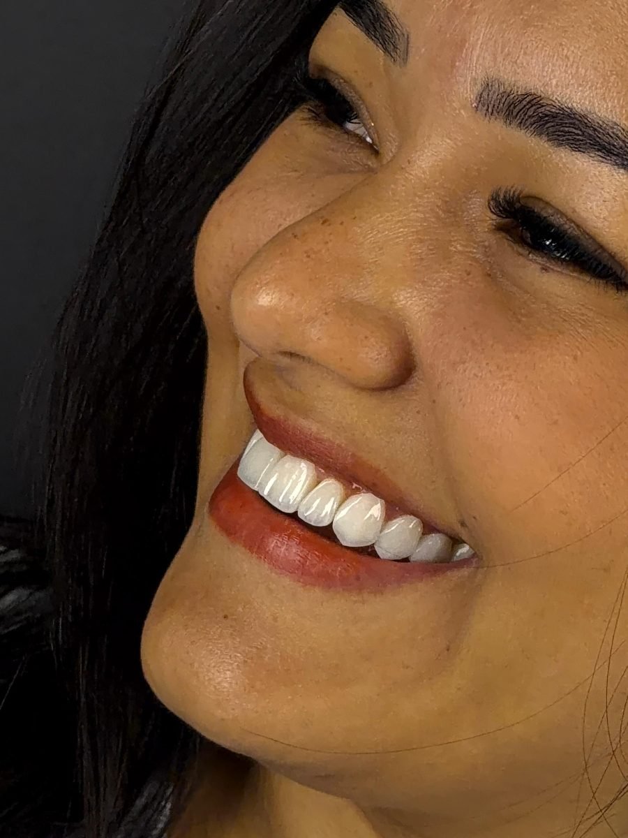 Paciente satisfeita com o novo sorriso